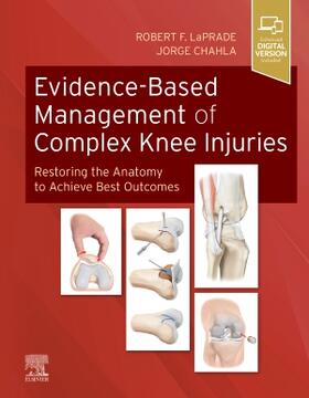 LaPrade / Chahla | Evidence-Based Management of Complex Knee Injuries | Buch | sack.de