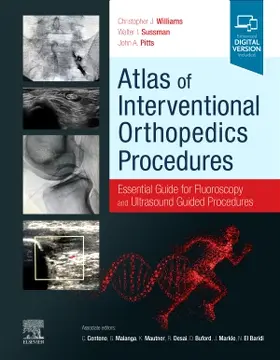 Williams / Sussman / Pitts |  Atlas of Interventional Orthopedics Procedures | Buch |  Sack Fachmedien