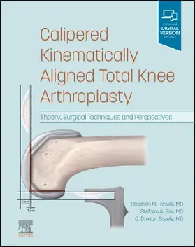 Howell / Bini / Steele |  Calipered Kinematically Aligned Total Knee Arthroplasty | Buch |  Sack Fachmedien