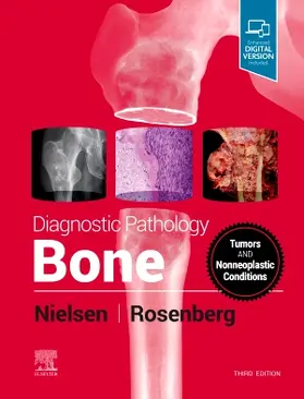 Rosenberg / Nielsen | Diagnostic Pathology: Bone | Buch | 978-0-323-76533-6 | www.sack.de
