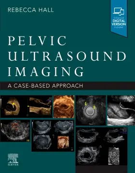 Hall |  Pelvic Ultrasound Imaging | Buch |  Sack Fachmedien