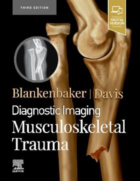 Blankenbaker / Davis | Diagnostic Imaging: Musculoskeletal Trauma | Buch | 978-0-323-79393-3 | sack.de