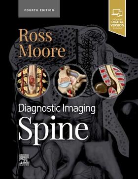Ross / Moore | Diagnostic Imaging: Spine | Buch | 978-0-323-79399-5 | sack.de
