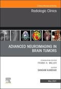 Kanekar |  Advanced Neuroimaging in Brain Tumors, An Issue of Radiologic Clinics of North America | Buch |  Sack Fachmedien
