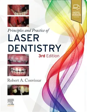 Convissar |  Principles and Practice of Laser Dentistry | Buch |  Sack Fachmedien