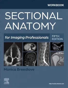 Breedlove | Workbook for Sectional Anatomy for Imaging Professionals | Buch | 978-0-323-82792-8 | www.sack.de