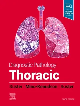 Suster / Mino-Kenudson | Diagnostic Pathology: Thoracic | Buch | 978-0-323-83476-6 | www.sack.de