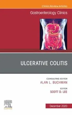 Lee MD / Lee |  Ulcerative Colitis, An Issue of Gastroenterology Clinics of North America, E-Book | eBook | Sack Fachmedien