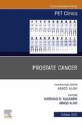 Alavi |  Prostate Cancer, An Issue of PET Clinics, E-Book | eBook | Sack Fachmedien