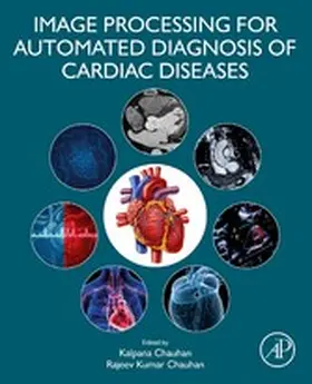 Chauhan | Image Processing for Automated Diagnosis of Cardiac Diseases | E-Book | sack.de