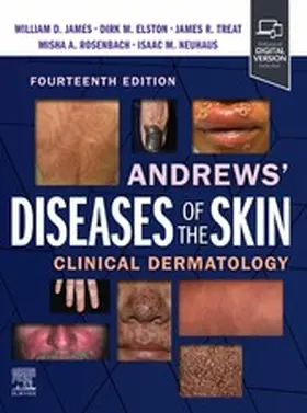 Rosenbach |  Andrews' Diseases of the Skin E-Book | eBook | Sack Fachmedien