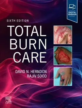Herndon / Sood | Total Burn Care | Buch | 978-0-323-88389-4 | www.sack.de