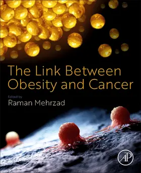 Mehrzad | The Link Between Obesity and Cancer | Buch | 978-0-323-90965-5 | sack.de