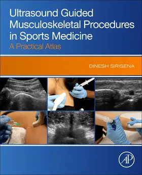 Sirisena |  Ultrasound Guided Musculoskeletal Procedures in Sports Medicine | Buch |  Sack Fachmedien