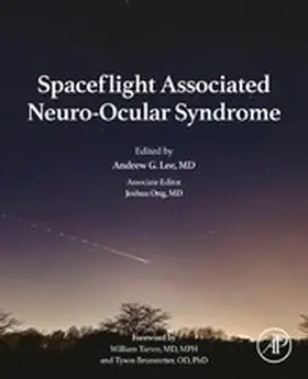 Lee MD / Ong MD | Spaceflight Associated Neuro-Ocular Syndrome | E-Book | www.sack.de