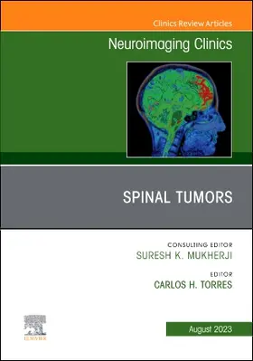 Torres |  Spinal Tumors, an Issue of Neuroimaging Clinics of North America | Buch |  Sack Fachmedien