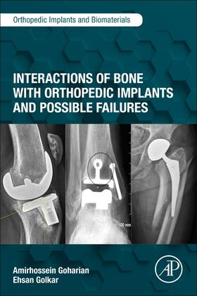 Goharian / Golkar | Interactions of Bone with Orthopedic Implants and Possible Failures | Buch | 978-0-323-95410-5 | sack.de