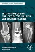 Goharian / Golkar |  Interactions of Bone with Orthopedic Implants and Possible Failures | Buch |  Sack Fachmedien