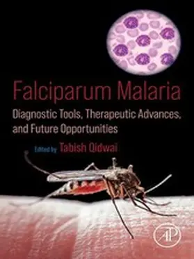 Qidwai |  Falciparum Malaria | eBook | Sack Fachmedien