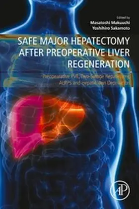 Sakamoto / Makuuchi |  Safe Major Hepatectomy after Preoperative Liver Regeneration | eBook | Sack Fachmedien