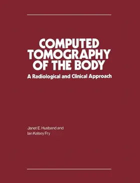 Husband / Fry | Computed Tomography of the Body | Buch | 978-0-333-25585-8 | www.sack.de