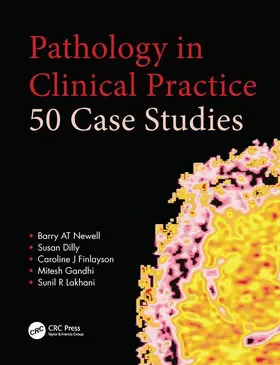 Newell / Dilly / Finlayson |  Pathology in Clinical Practice: 50 Case Studies | Buch |  Sack Fachmedien