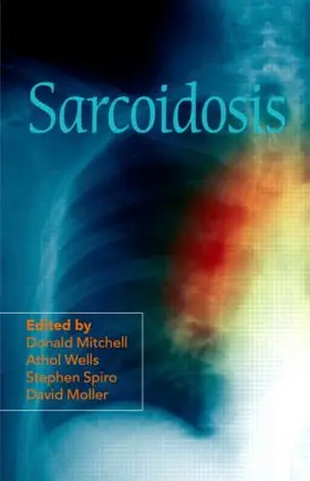 Mitchell / Wells / Spiro |  Sarcoidosis | Buch |  Sack Fachmedien