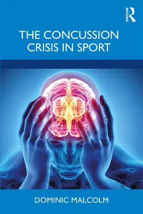 Malcolm |  The Concussion Crisis in Sport | Buch |  Sack Fachmedien