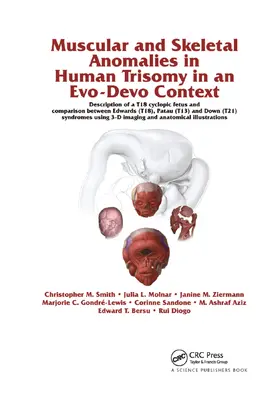 Diogo / Smith / Ziermann |  Muscular and Skeletal Anomalies in Human Trisomy in an Evo-Devo Context | Buch |  Sack Fachmedien
