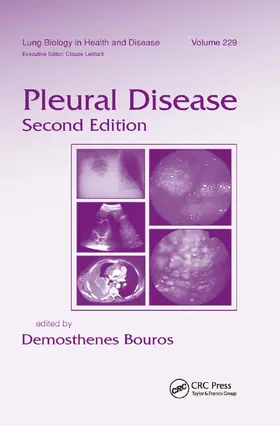 Bouros |  Pleural Disease | Buch |  Sack Fachmedien