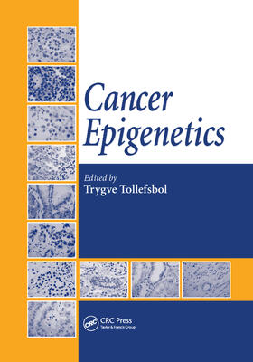 Tollefsbol | Cancer Epigenetics | Buch | 978-0-367-38686-3 | sack.de