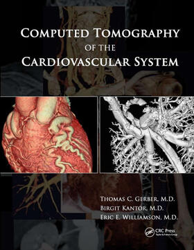 Gerber / Kantor / Williamson | Computed Tomography of the Cardiovascular System | Buch | 978-0-367-38783-9 | sack.de
