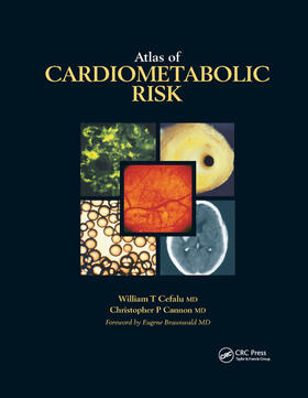 Cefalu / Cannon | Atlas of Cardiometabolic Risk | Buch | 978-0-367-38924-6 | sack.de