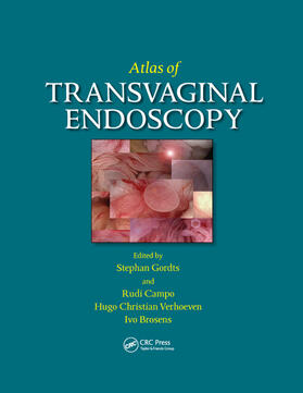 Gordts / Verhoeven / Campo | Atlas of Transvaginal Endoscopy | Buch | 978-0-367-38954-3 | sack.de