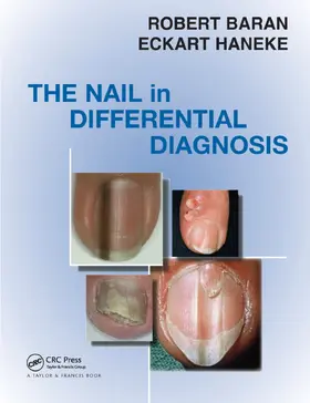Baran / Haneke |  Nail in Differential Diagnosis | Buch |  Sack Fachmedien