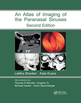 Shankar / Evans | Atlas of Imaging of the Paranasal Sinuses, Second Edition | Buch | 978-0-367-39072-3 | sack.de