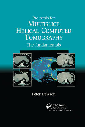 Peter | Protocols for Multislice Helical Computed Tomography | Buch | 978-0-367-39120-1 | sack.de