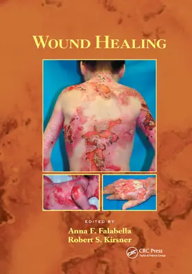 Falabella / Kirsner | Wound Healing | Buch | 978-0-367-39233-8 | www.sack.de