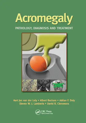 van der Lely / Beckers / Daly | Acromegaly | Buch | 978-0-367-39258-1 | www.sack.de