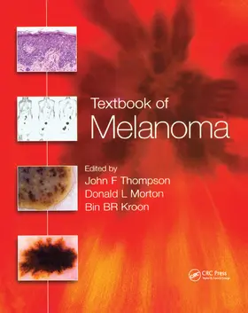 Thompson / Morton / Kroon |  Textbook of Melanoma | Buch |  Sack Fachmedien