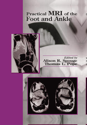 Spouge / Pope | Practical MRI of the Foot and Ankle | Buch | sack.de