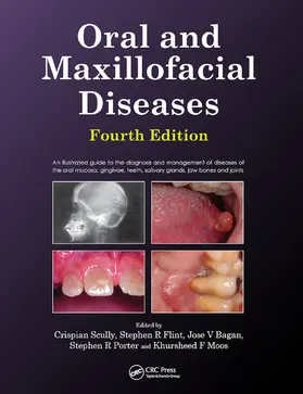 Scully / Flint |  Oral and Maxillofacial Diseases, Fourth Edition | Buch |  Sack Fachmedien