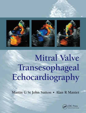 St. John Sutton / Maniet | Mitral Valve Transesophageal Echocardiography | Buch | 978-0-367-44642-0 | sack.de