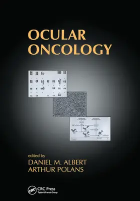 Albert / Polans |  Ocular Oncology | Buch |  Sack Fachmedien