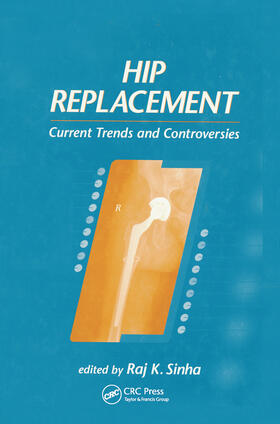 Sinha | Hip Replacement | Buch | 978-0-367-44699-4 | sack.de