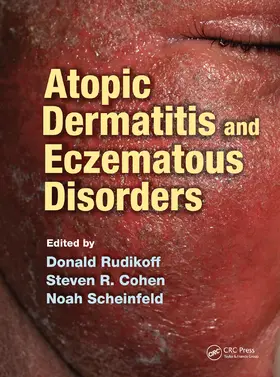 Rudikoff / Cohen / Scheinfeld |  Atopic Dermatitis and Eczematous Disorders | Buch |  Sack Fachmedien