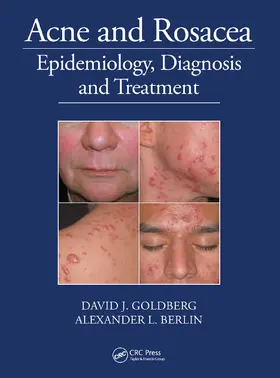 Goldberg / Berlin |  Acne and Rosacea | Buch |  Sack Fachmedien