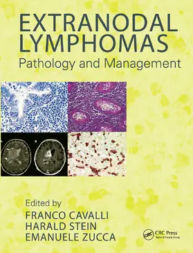 Cavalli / Stein / Zucca |  Extranodal Lymphomas | Buch |  Sack Fachmedien