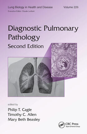 Cagle / Allen / Beasley | Diagnostic Pulmonary Pathology | Buch | sack.de