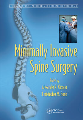 Vaccaro / Bono |  Minimally Invasive Spine Surgery | Buch |  Sack Fachmedien